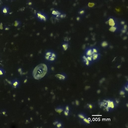 Foto: Coccolithen (Überreste mariner, einzelliger Algen). Erkundungsbohrung Schermbeck