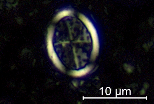 Foto zeigt fossilen Überrest einer mikroskopisch kleinen Alge, ein sogenanntes kalkiges Nannofossil.